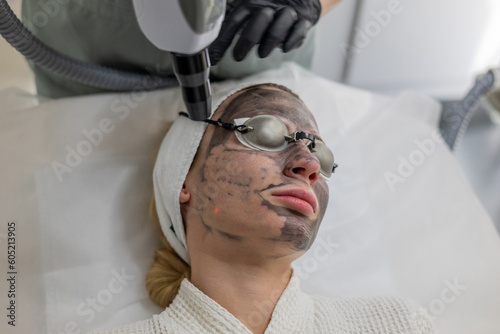 Beautician performs a carbon fiber based skin exfoliation treatment. The cosmetologist administers the carbon face peeling procedure, utilizing specialized equipment for effective results.