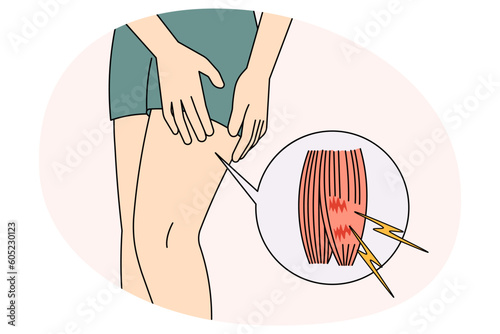 Sportsman tear leg muscle suffer from pain