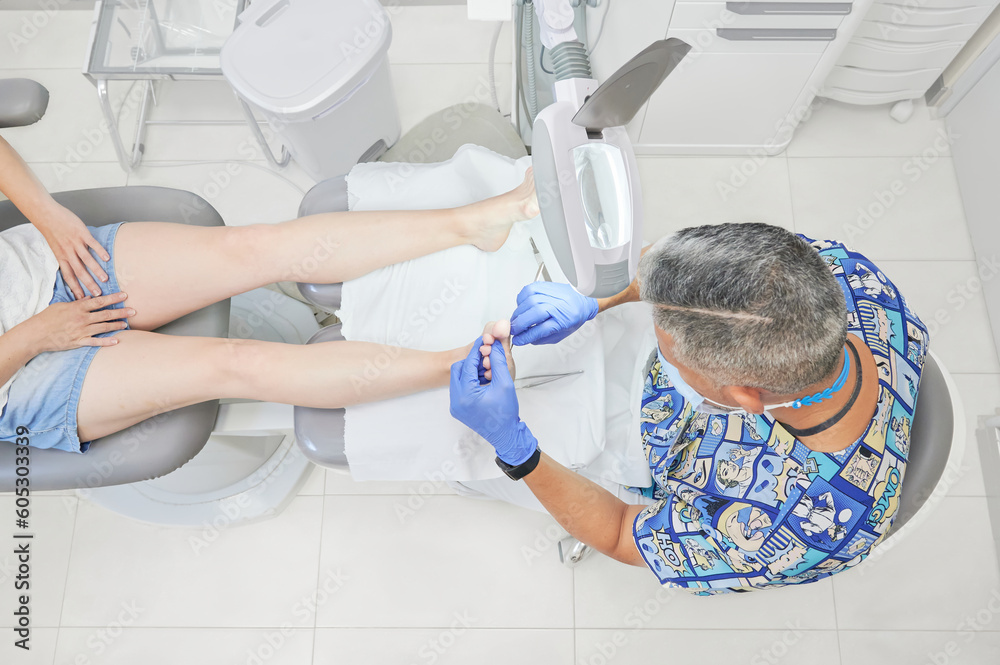 Podiatrist doctor checks the feet of a patient who needs to remove a callosity (hyperkeratosis) from the sole of the foot. Scenes from a podiatry clinic. Podiatrist doctor checks the feet of a patient who needs to remove a callosity (hyperkeratosis) from the sole of the foot. Scenes from a podiatry clinic.