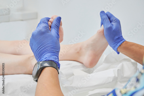 Podiatrist doctor checks and massage the feet of a patient after removing a callosity (hyperkeratosis) from the sole of the foot. Scenes from a podiatry clinic.