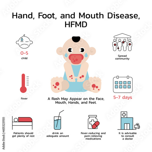 Hand, foot and mouth disease (HFMD) with symptoms prevention and treatment Infographics.