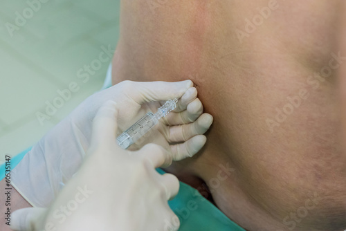 Surgical room lumbar spinal puncture procedures for collecting samples in patient