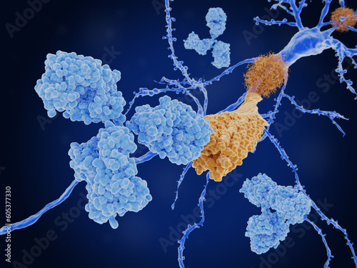 Immunotherapy of Alzheimer's disease. Antibody binding to an amyloid beta fibril. photo