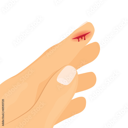 bleeding blood from the finger wound- vector illustration