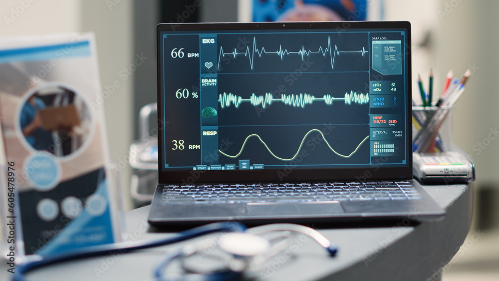 Heartbeat on laptop at empty front desk, running cardiogram for heart rate analysis. Empty diagnostic center counter with pc showing pulse pressure for diagnosis. Handheld shot. Close up. Heartbeat on laptop at empty front desk, running cardiogram for heart rate analysis. Empty diagnostic center counter with pc showing pulse pressure for diagnosis. Handheld shot. Close up.