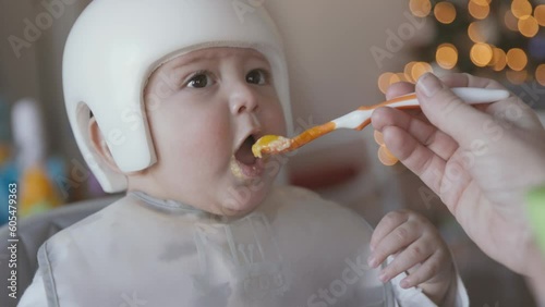 8 Month Old Baby Wearing Therapy Helmet In High Chair Being Fed Follow Hesitant to Eat. slow motion of an 8 month old in a high chair wearing a corrective therapy helmet and being fed and view follows photo