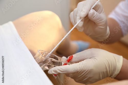 The gynecologist takes a vaginal swab for bacterial examination. Gynecological chair. A woman at the gynecologist for a check-up.