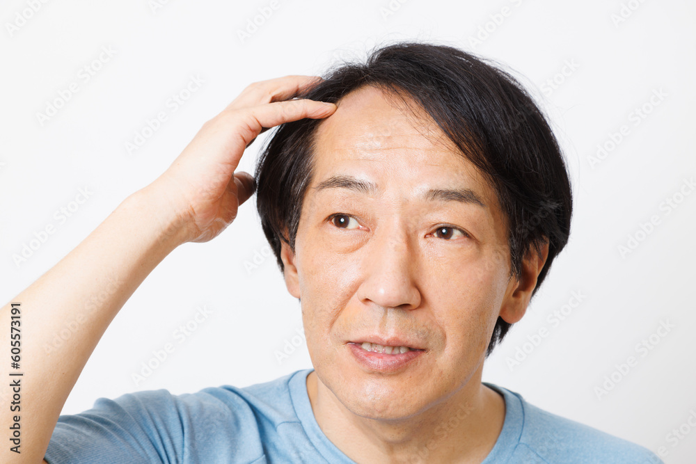 脱毛の問題を抱える成熟した日本人 脱毛の問題を抱える成熟した日本人