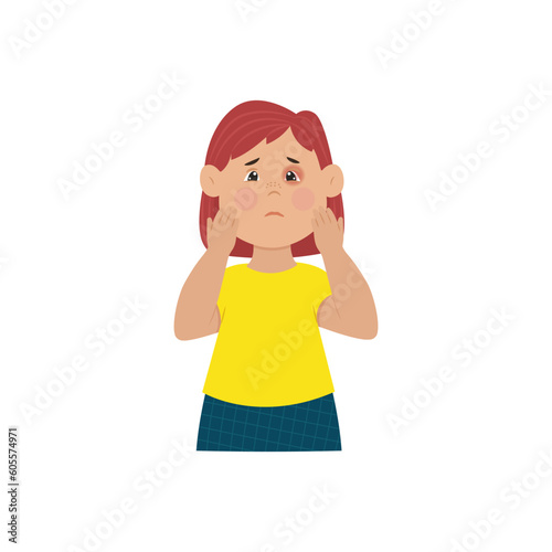Inflammation of the eye, Conjunctivitis in children. Viral and infectious diseases in children. Ophthalmia. Vector illustration.