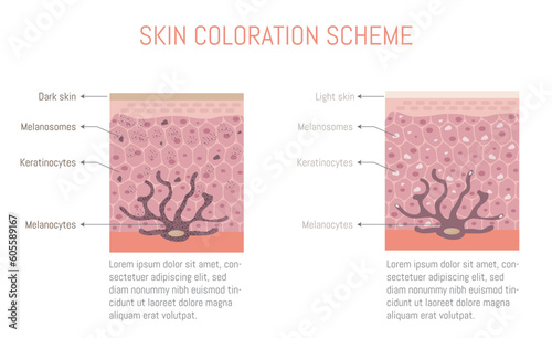 Diagram of skin coloration, for light and dark skin. Diagram of a melanocyte.