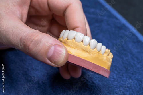 A jaw with ceramic teeth. Dentist's device in the hand. Close-up
