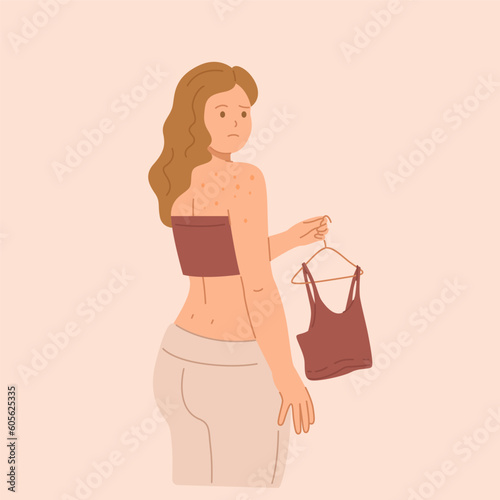 Young sad woman with pimples on her back.