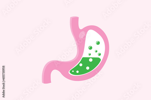indigestion. medical illustration of nausea stomach isolated. Green liquid inside stomach.