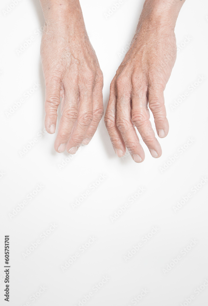 Fototapeta premium Fingers of elderly people with symptoms of muscle and joint problems, bone marrow