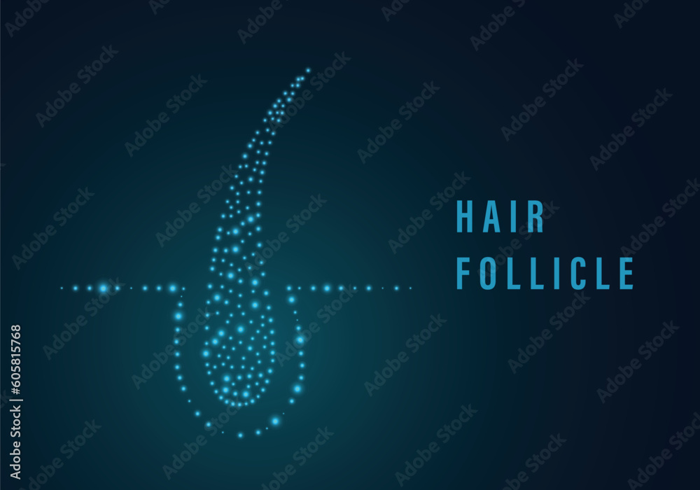 Vetor de Hair follicle. Malepattern baldness, alopecia, thinning hair