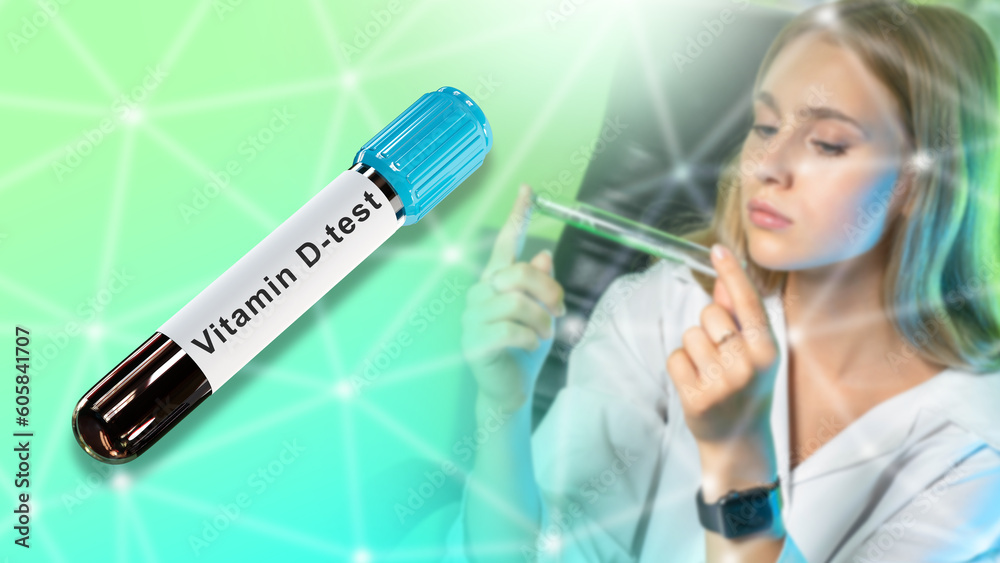 Vitamin d test. Doctor woman. Test tube with blood. Analysis for vitamin d content. Girl checks