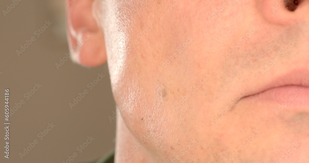 The movement of the muscles of the cheekbones of a man on the cheek