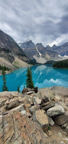 Vertical shot of the Louise lake in a mountainous landscape at daytime in Canada