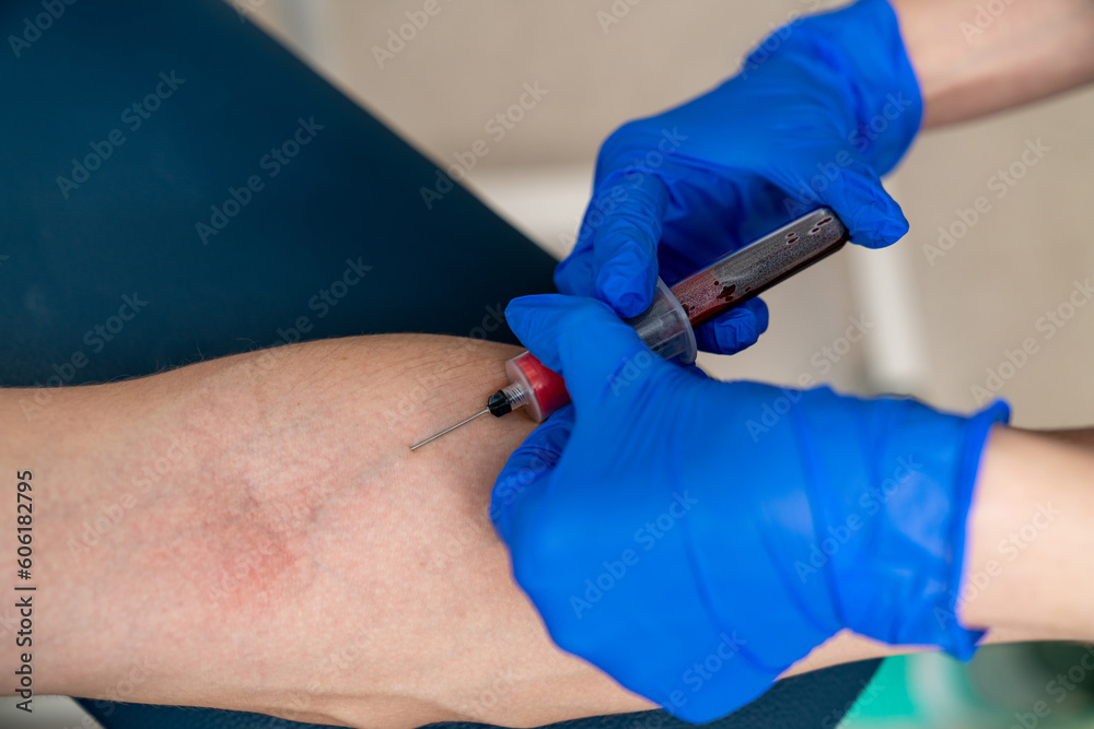 Hospital nurse making injection in hand. Arm medical injection.
