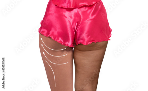 Woman's thighs and buttocks...
