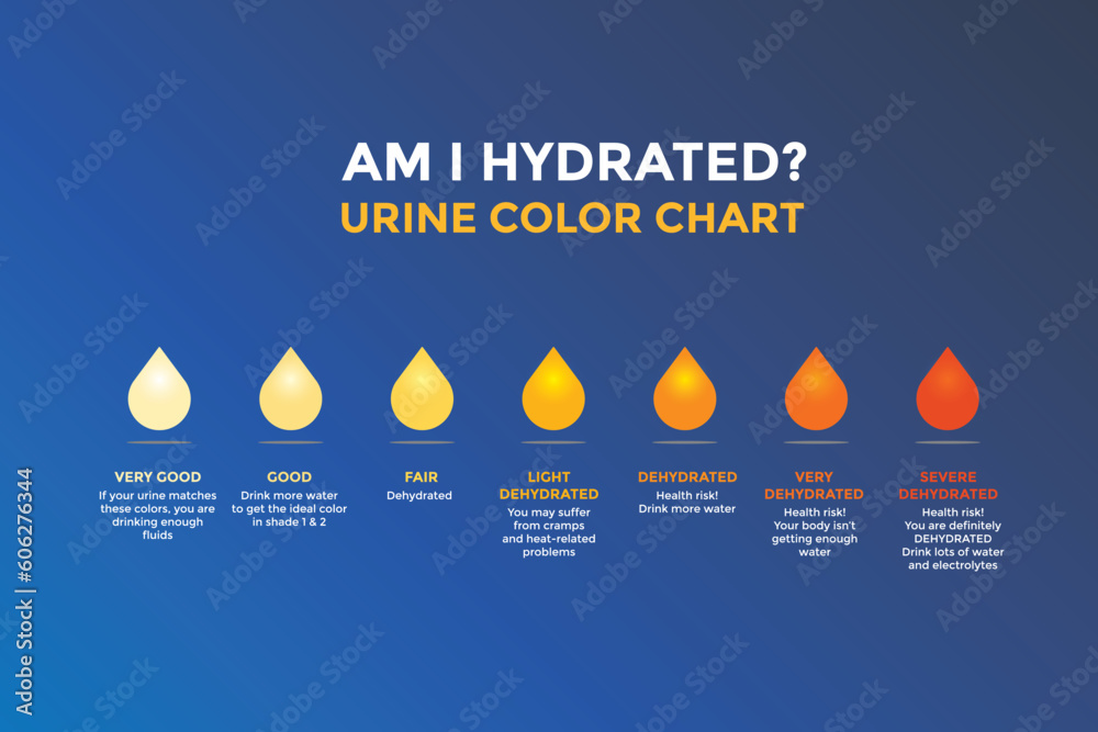 Urine color chart diagram. Vector infographic urine chart illustration Urine Colour Chart Qld Health