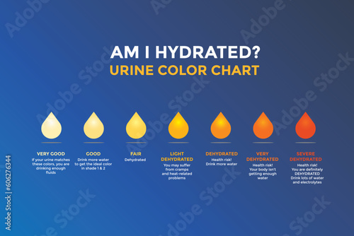 Urine color chart diagram. Vector infographic urine chart illustration photo