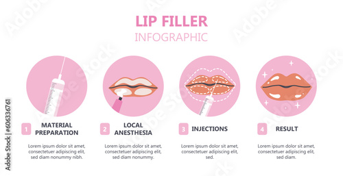 Lip filler infographic. Data visualization and tutorials. Botox injections and facelifting, plastic surgery. Beauty, elegance and aesthetics. Flat vector illustration isolated on white background