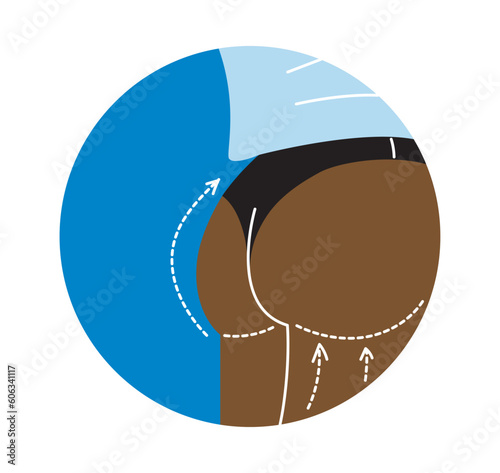 Plastic surgery icon concept. Butt reshaping and liposuction, fat removal, lift. Reconstruction and reshape of body in clinic. Cartoon flat vector illustration isolated on white background