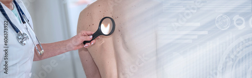 Dermatologist examining the skin of a patient; panoramic banner