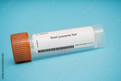 Stool Lysozyme Test photo