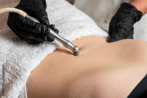 body aesthetic treatment with diamond tip method on the body of a woman for the beauty of the skin and abdomen