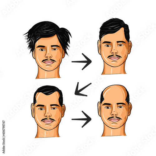 Vector Illustrated set with hair transplant surgery. Infographics with icons of plastic surgery procedures.