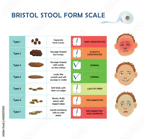 Bristol stool scale table. Medical diagnostic infographics, different poop type from constipation to diarrhea. Vector illustration for posters, articles about helthy diet, digestive system.