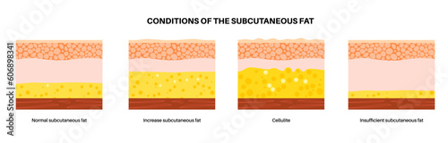 Subcutaneous fat level