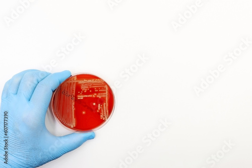 Doctor's or scientist's glove with a Petri dish with Agar-Blood medium with a culture of the bacteria Methicillin-resistant Staphylococcus aureus (MRSA)  photo