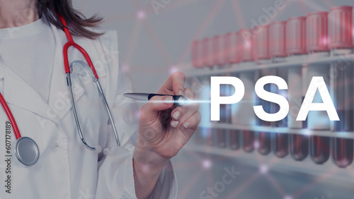 PSA disease. Doctor with na...