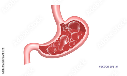 Human stomach problems, Gastrointestinal diseases. Common Digestive Disorders. Poor Digestive conditions. How right medication keep your stomach healthy. Student biology study material images.