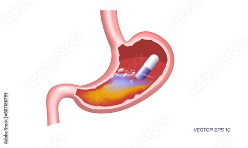 Human stomach problems, Gastrointestinal diseases. Common Digestive Disorders. Poor Digestive conditions. How right medication keep your stomach healthy. Student biology study material images.