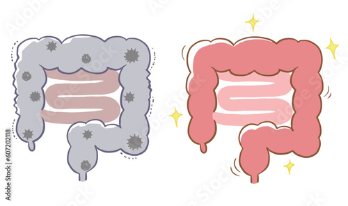 悪い状態の腸といい状態の腸のベクターイラスト