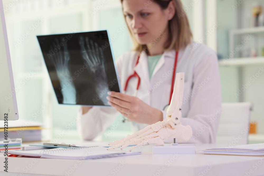 Doctor in work uniform examines bone injury on X-ray image Doctor in work uniform examines bone injury on X-ray image