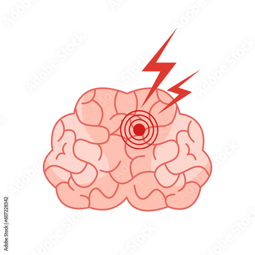 Human brain stroke problem in flat design. Brain disease.