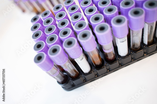 Laboratory vacuum blood sampling tubes on white background
