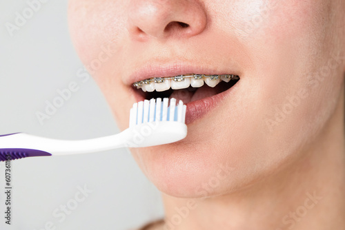 Photo of a young woman with braces on her teeth brushing her teeth with a toothbrush close-up. dental and oral care.