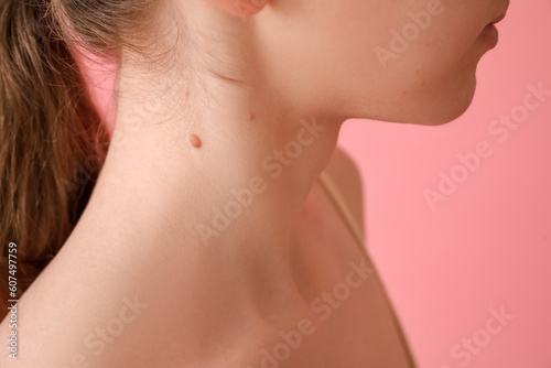Young woman with mole on pink background, closeup