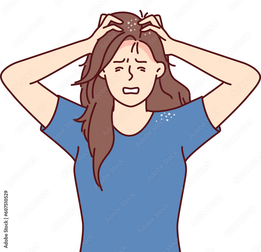 Woman suffers from itchy head after fungal infection and dandruff associated with bad hair shampoo Woman suffers from itchy head after fungal infection and dandruff associated with bad hair shampoo