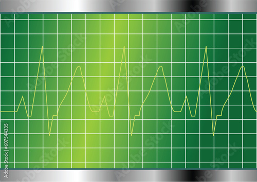 Cardiology test. Electrocardiogram monitor with cardio beat