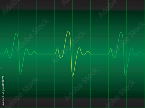 Heart cardiogram vector illustration
