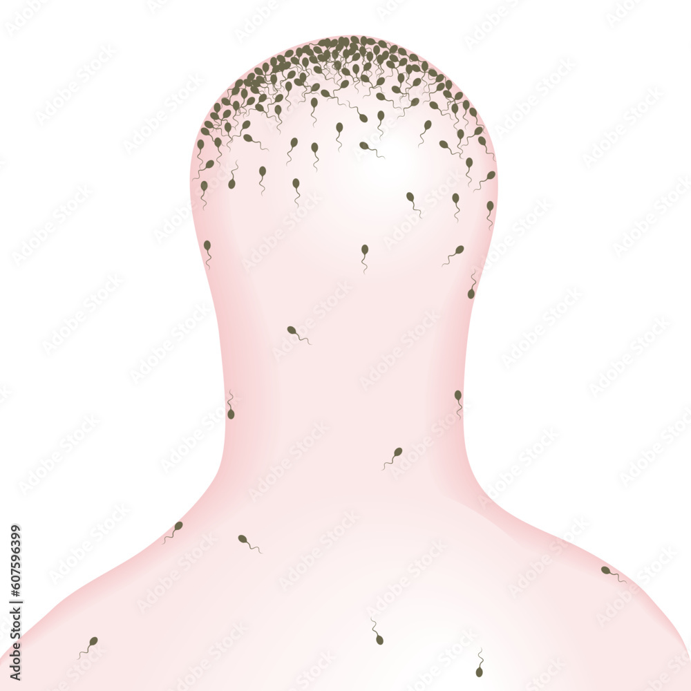 Editable vector illustration of sperm swimming in a condom Editable vector illustration of sperm swimming in a condom