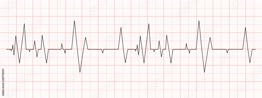 Black heartbeat diagram on red graph paper. Electrocardiogram chart. Cardio test line. Cardiac rhythm symbol. Vector graphic illustration