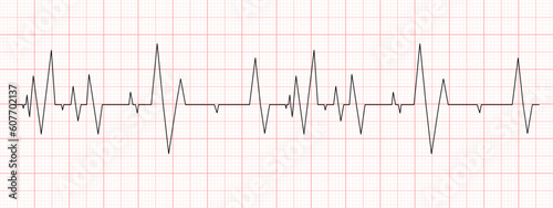 Black heartbeat diagram on red graph paper. Electrocardiogram chart. Cardio test line. Cardiac rhythm symbol. Vector graphic illustration